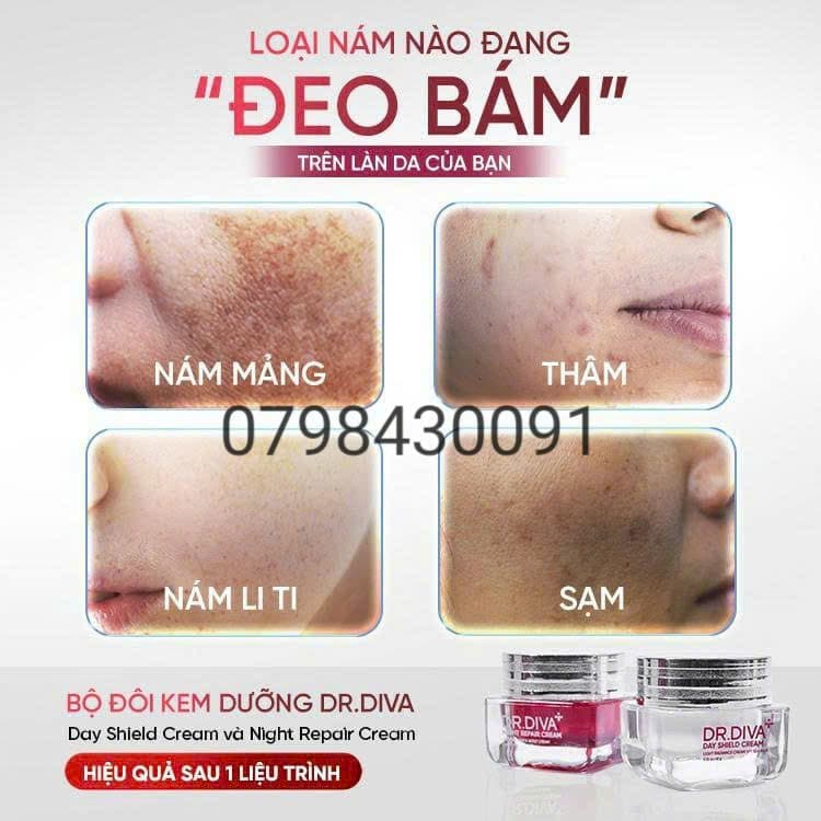 kem dr diva tri tat ca cac loai nam